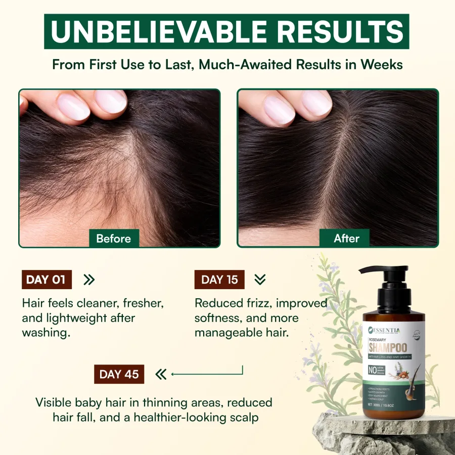 Rosemary Sulfate Free Shampoo for Hair Fall Solution – 100% Natural Formula (300g)