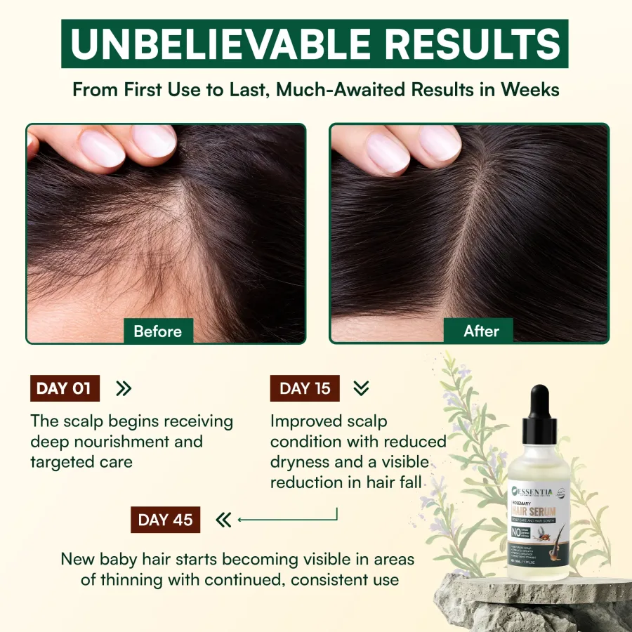 Rosemary Hair Growth Serum – Lightweight, Less Hair Fall & Healthy Scalp (50ml)