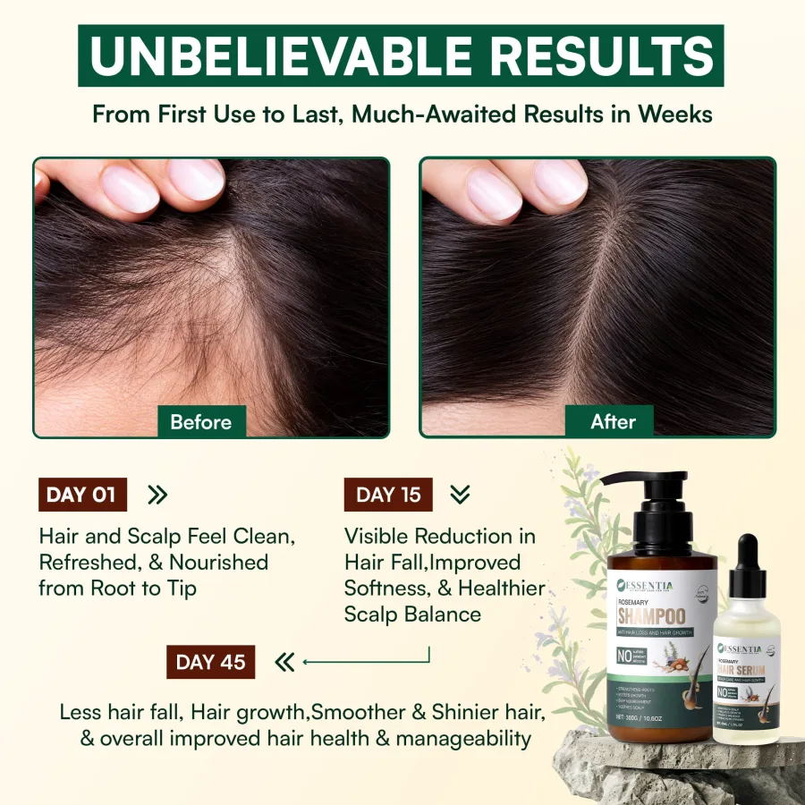 Rosemary Anti-Hair Loss & Hair Growth Combo – Sulfate free Shampoo 300g + Serum 50ml