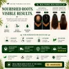 Rosemary Sulfate Free Shampoo for Hair Fall Solution – 100% Natural Formula (300g)