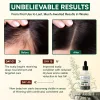 Rosemary Hair Growth Serum – Lightweight, Less Hair Fall & Healthy Scalp (50ml)