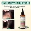 Premium Rosemary Oil Blend for Healthier-Looking, Beautiful Hair (200ml)