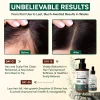Rosemary Anti-Hair Loss & Hair Growth Combo – Sulfate free Shampoo 300g + Serum 50ml